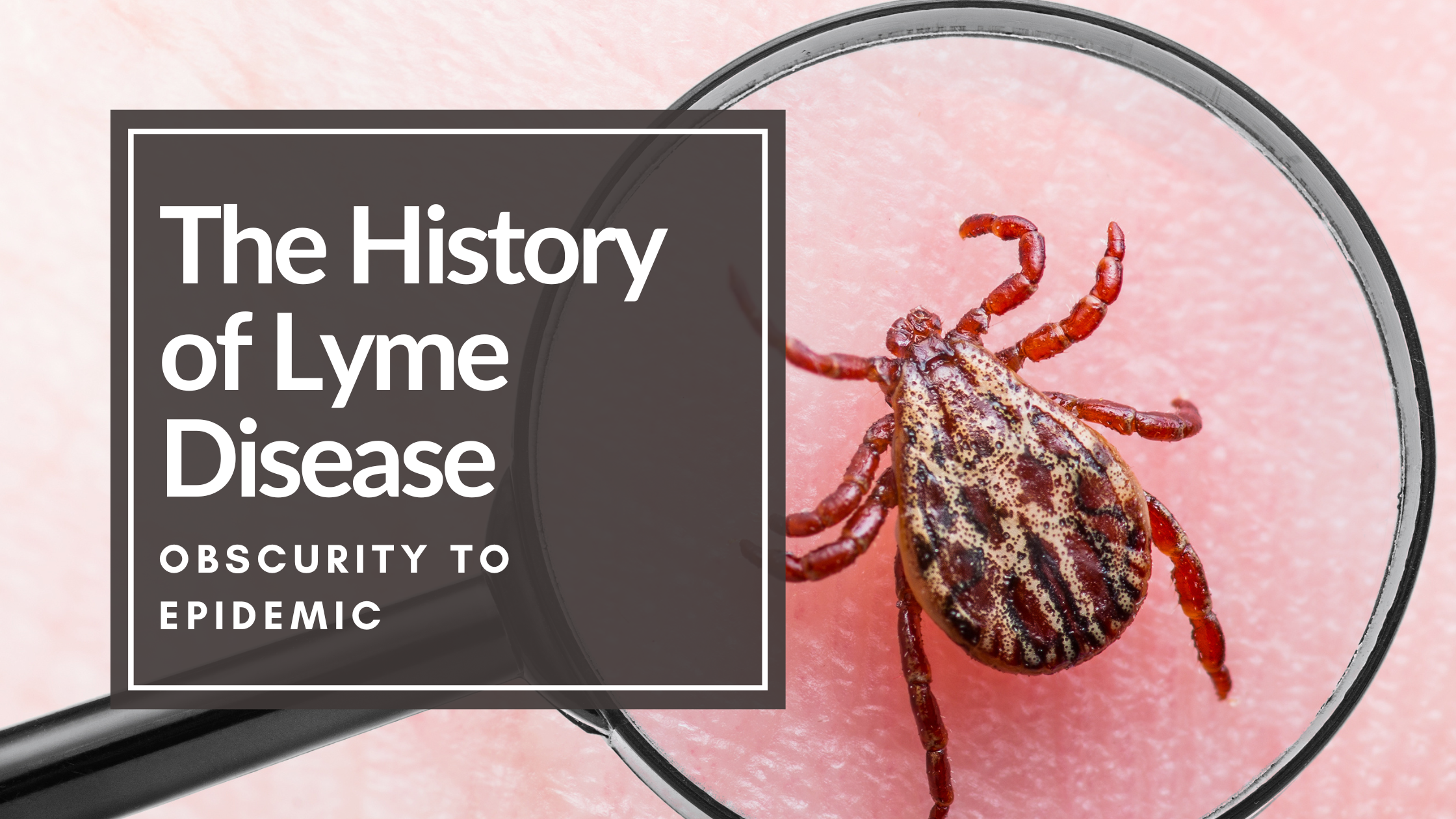 Picture of a tick under a magnifying glass. with overlay text the history of lyme disease