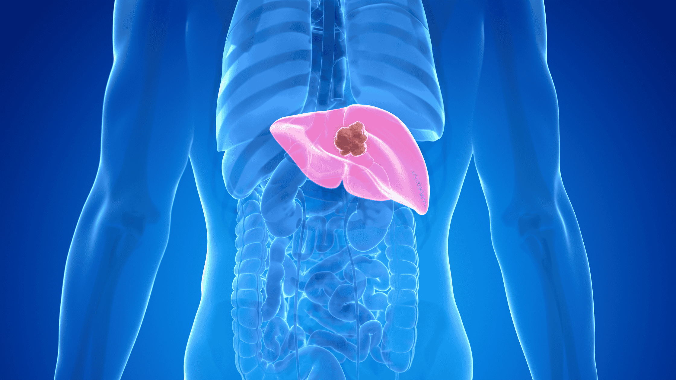 A x-ray like image of the body and liver. 